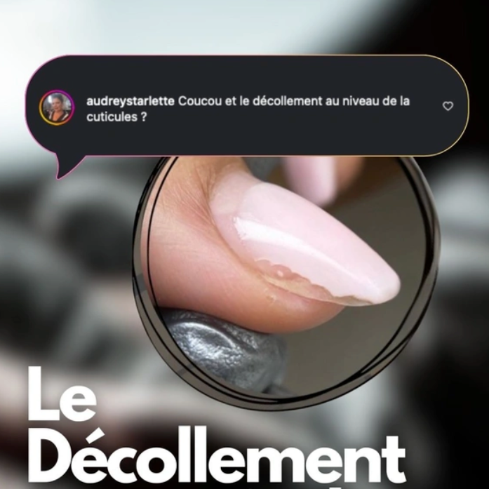 Décollement de gel au niveau des cuticules — cause fréquente chez les prothésistes ongulaires et solutions pro ALBI