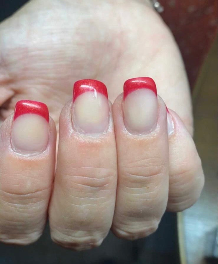 Jaunissement de l’ongle naturel visible sous un vernis semi-permanent rouge — exemple de décoloration liée à l’absence de filtre UV dans le top coat